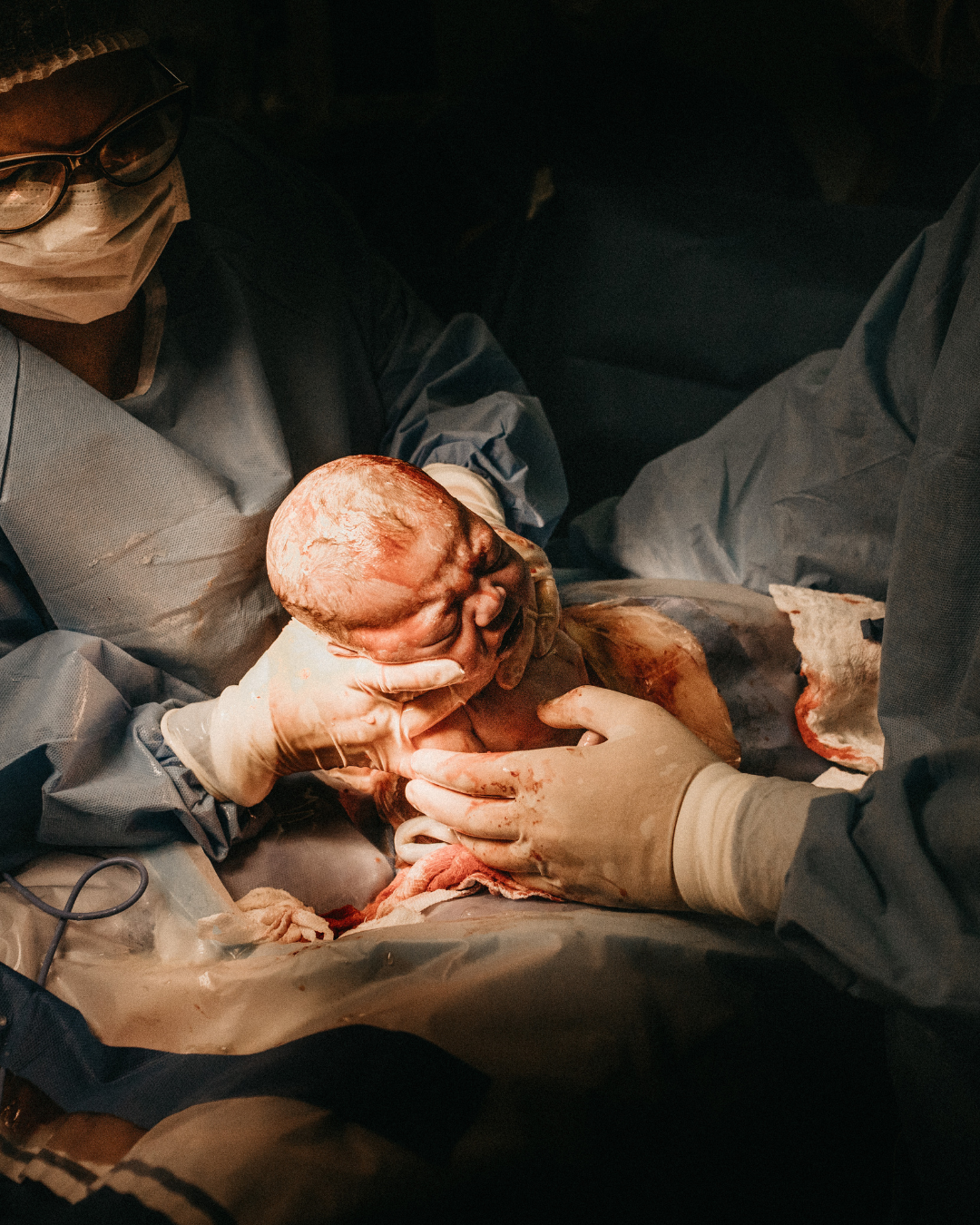 What to expect from your planned or emergency c-section