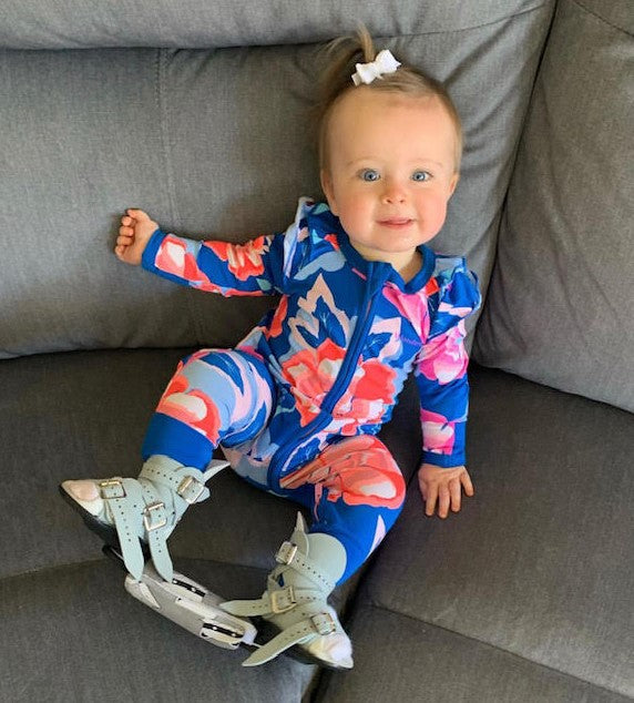 Clubfoot: Two Mama's Journeys