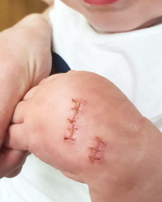 Preventing Dog Bites to Your Little One
