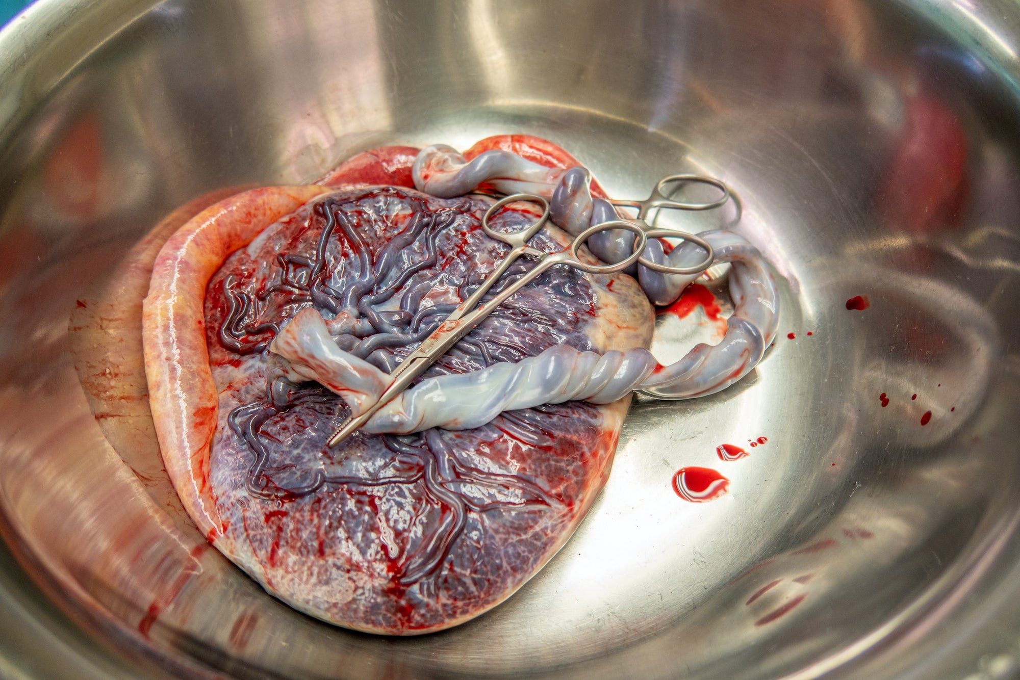 Everything You've Ever Wondered About the Placenta