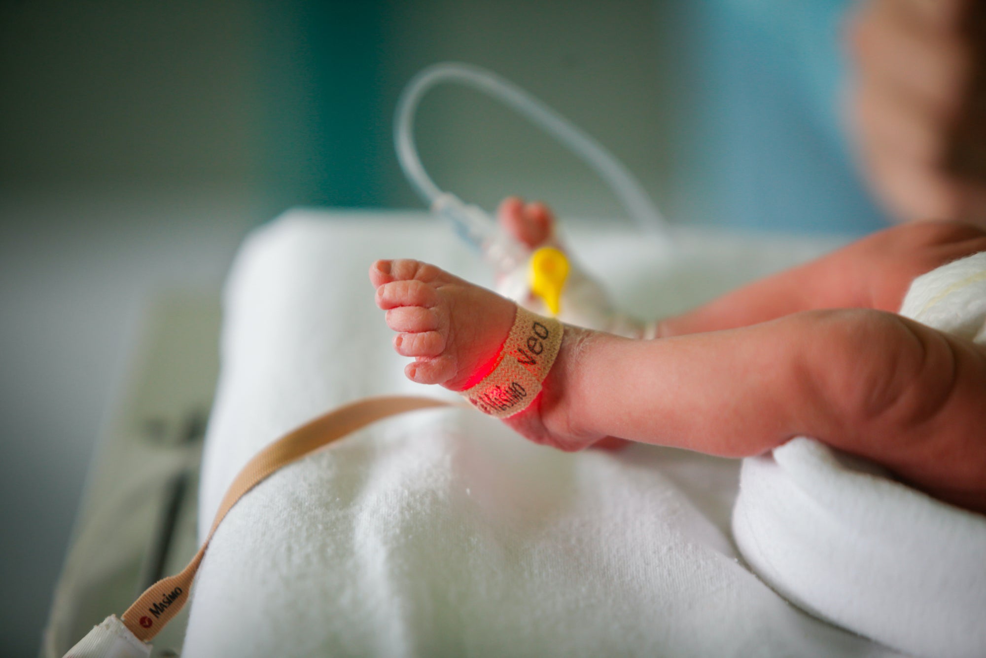 Preterm Labour - What You Need to Know