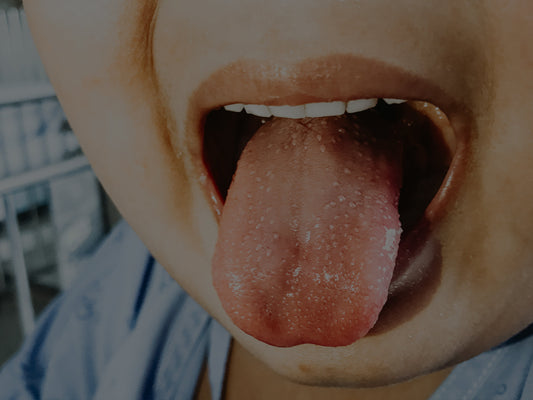 Kawasaki Disease - Aurora's Story