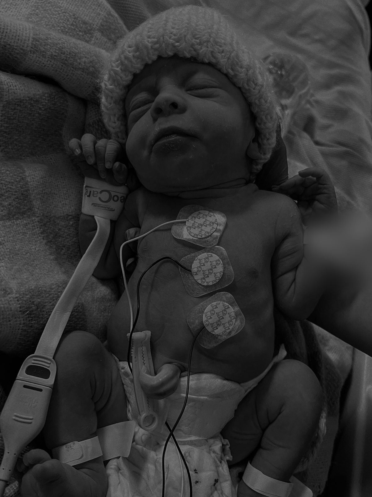 A newborn baby in hospital wearing a knitted beanie, with monitoring dots on their chest